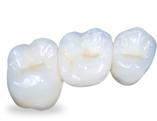prismatik-clinical-zirconia.png